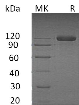 Recombinant Human SEMA4B (C-Fc-6His)