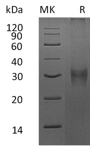 Recombinant Mouse Asprosin (N-8His)