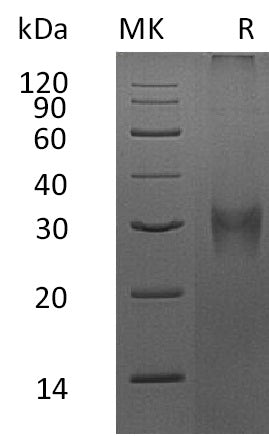 Recombinant Mouse Asprosin (N-8His)