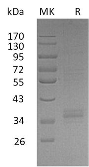 Recombinant Human TREML2 (C-Fc)
