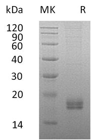 Recombinant Human CCL24 (C-6His)