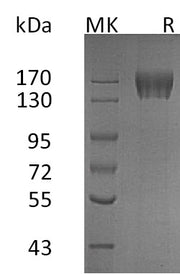 Recombinant Human CD117 (C-6His)