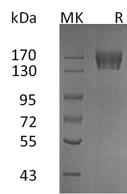 Recombinant Human CD117 (C-6His)
