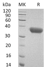 Recombinant Mouse CXCL16 (C-6His)