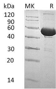 Recombinant Human BPI (C-6His)