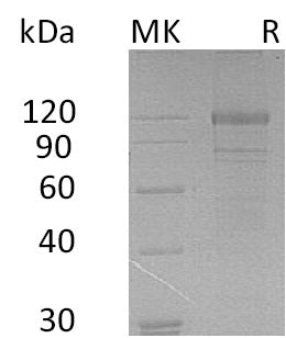 Recombinant Human FLT3 (C-Fc)