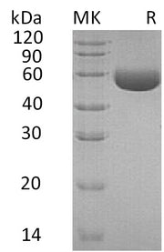 Recombinant Human CPM (C-6His)
