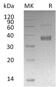 Recombinant Human ADAMDEC1 (C-6His)