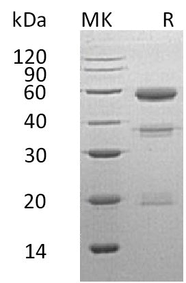 Recombinant Human CPE (C-6His)
