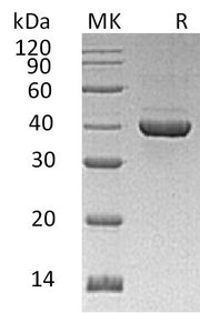 Recombinant Human ALDOC (C-6His)