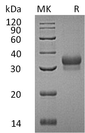 Recombinant Human EFNB1 (C-6His)