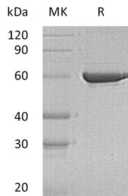 Recombinant Human PKLR (C-6His)
