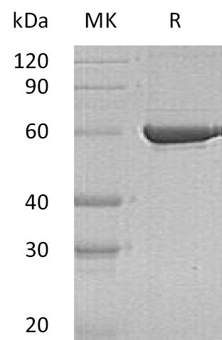 Recombinant Human PKLR (C-6His)