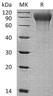 Recombinant Human MANSC1 (C-6His)