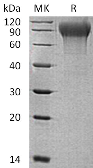 Recombinant Human MANSC1 (C-6His)