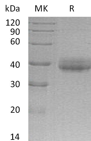 Recombinant Human CRELD2 (C-6His)