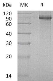 Recombinant Human INPP1 (C-6His)