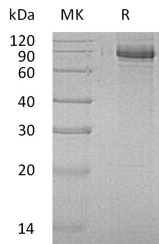 Recombinant Human INPP1 (C-6His)