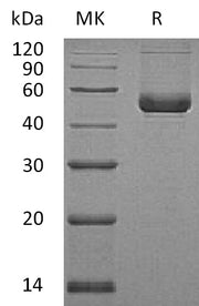 Recombinant Human Serpin E2 (C-6His)