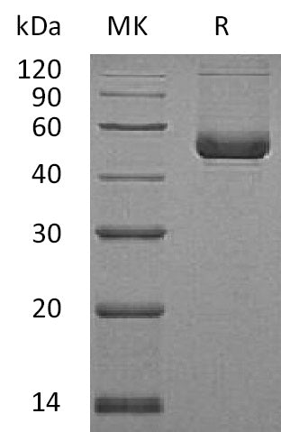 Recombinant Human Serpin E2 (C-6His)