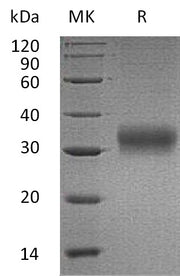Recombinant Human AMBP (C-6His)
