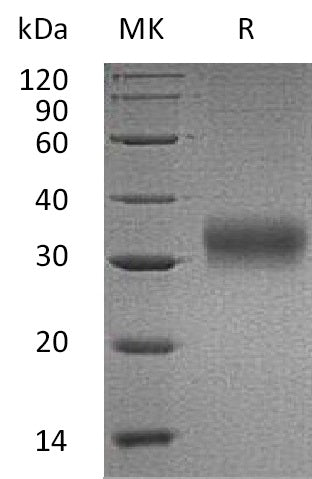 Recombinant Human AMBP (C-6His)