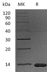 Recombinant Cynomolgus B2M (C-6His)
