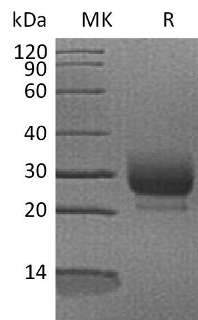 Recombinant Human RNASE3 (C-6His)