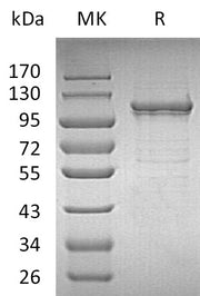 Recombinant Human IDE (C-6His)