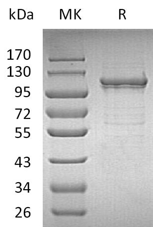 Recombinant Human IDE (C-6His)