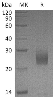 Recombinant Human UPK2 (C-6His)