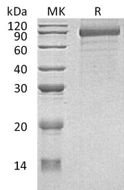 Recombinant Human CDH8 (C-6His)