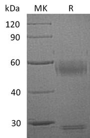 Recombinant Human MMP-8 (C-10His)