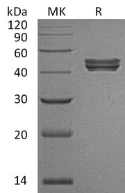 Recombinant Human Sialidase-1 (C-6His)