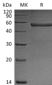 Recombinant Mouse PTX3 (N-6His)