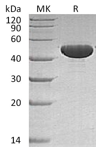 Recombinant Human ApoA4 (C-6His)