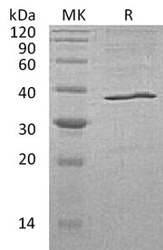 Recombinant Human AKR1C3 (C-6His)