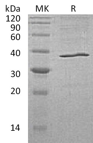 Recombinant Human AKR1C3 (C-6His)