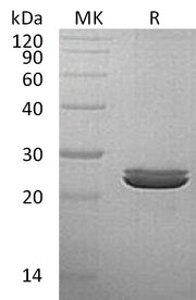 Recombinant Human LYG2 (C-6His)