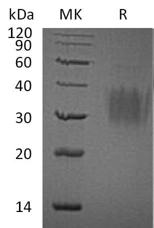 Recombinant Human IL-9 (C-6His)
