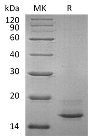 Recombinant Human CALCA (C-6His, Mammalian)