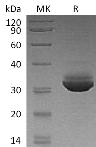 Recombinant Human CELA3A (C-6His)
