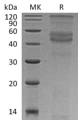 Recombinant Human DMP-1 (C-6His)