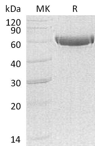 Recombinant Human CPB2 (C-6His)