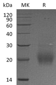 Recombinant Human FSHB (C-6His)