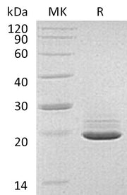 Recombinant Human PRAP1 (C-6His)
