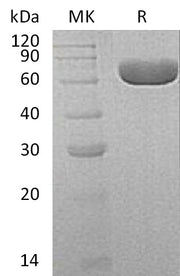 Recombinant Human SIAE (C-6His)