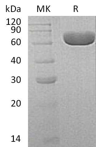 Recombinant Human SIAE (C-6His)