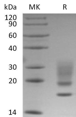 Recombinant Human RNASE 1 (C-6His)