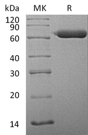 Recombinant Human SGSH (C-6His)